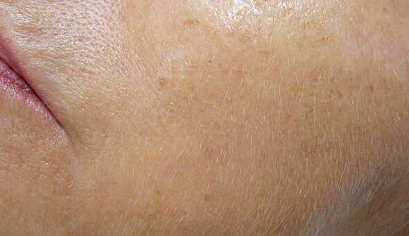 découvrez les bienfaits du peeling visage et nos conseils pour une peau éclatante et revitalisée. apprenez comment choisir et réaliser le peeling adapté à votre type de peau.