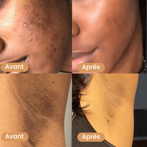 découvrez les bienfaits du savon au curcuma pour une peau éclatante, nettoyée en profondeur et revitalisée naturellement.