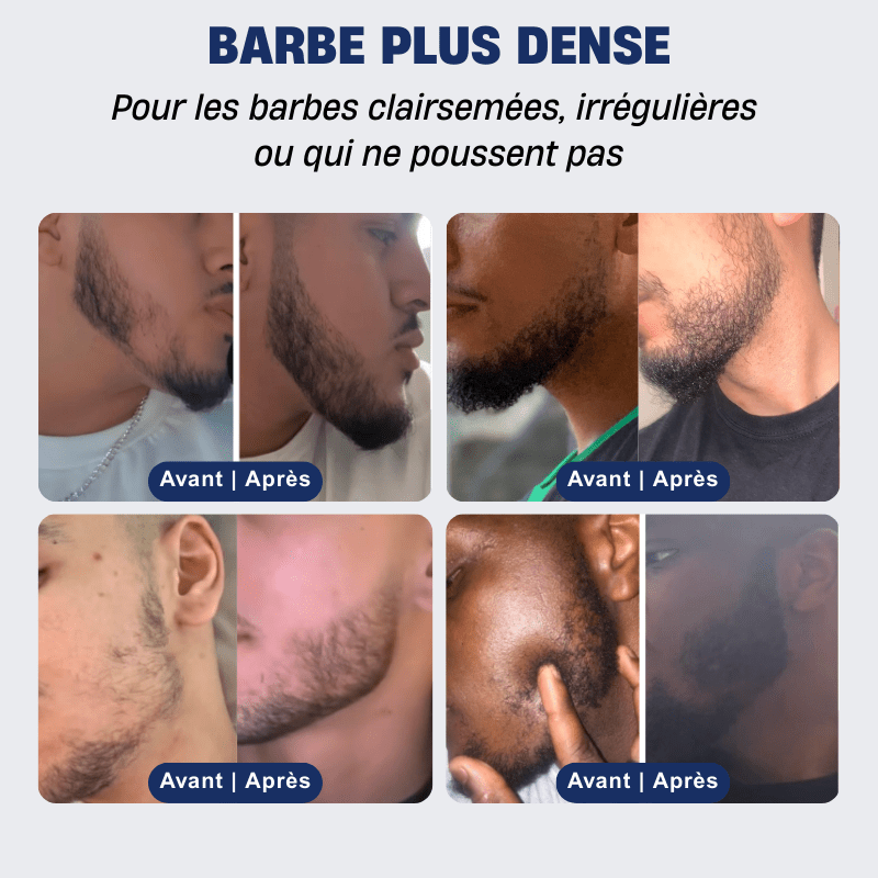 découvrez nos conseils pour choisir et utiliser l'huile pour barbe afin d'obtenir une barbe dense, douce et bien entretenue.