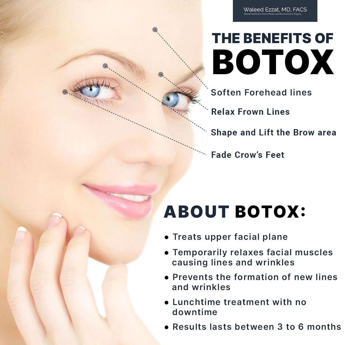découvrez les bienfaits du botox : une solution efficace pour lisser les rides, rajeunir votre peau et retrouver une apparence naturelle et éclatante.