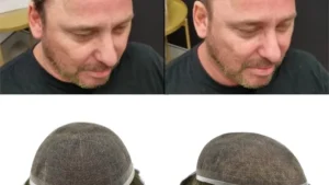 Tout savoir sur le postiche cheveux homme : guide et conseils pratiques